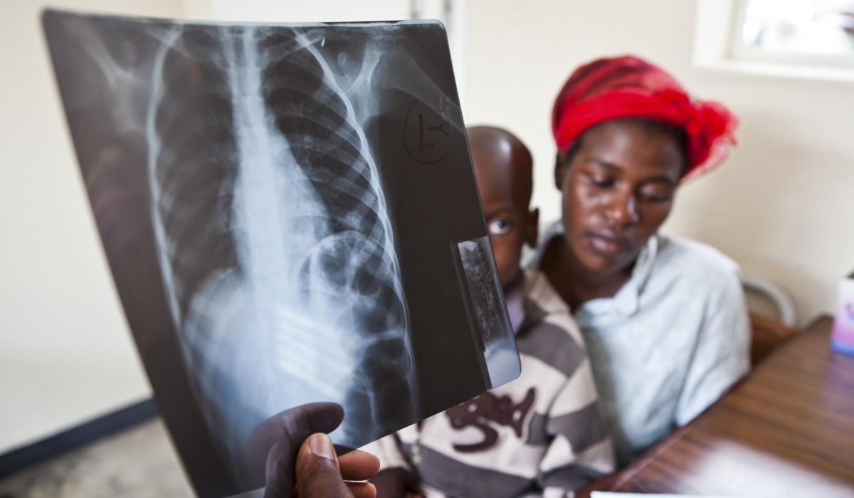 A woman with her baby who is a patient of tubeculose. Rwanda joins the world to mark World Tuberculosis (TB) Day on, March 24.