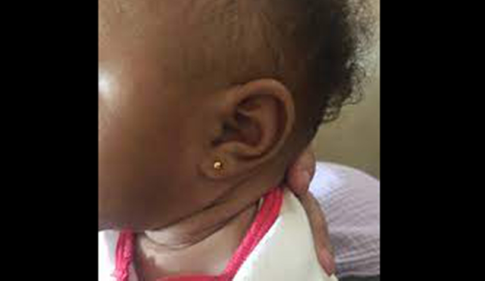 Piercing child’s ears,  has been compared as a violation of sorts, and that such parents may even be accused of abuse. Internet