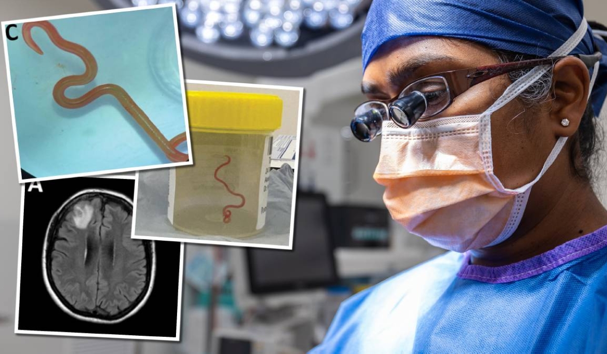 Neurosurgeon Hari Priya Bandi removes live worm from woman&#039;s brain.