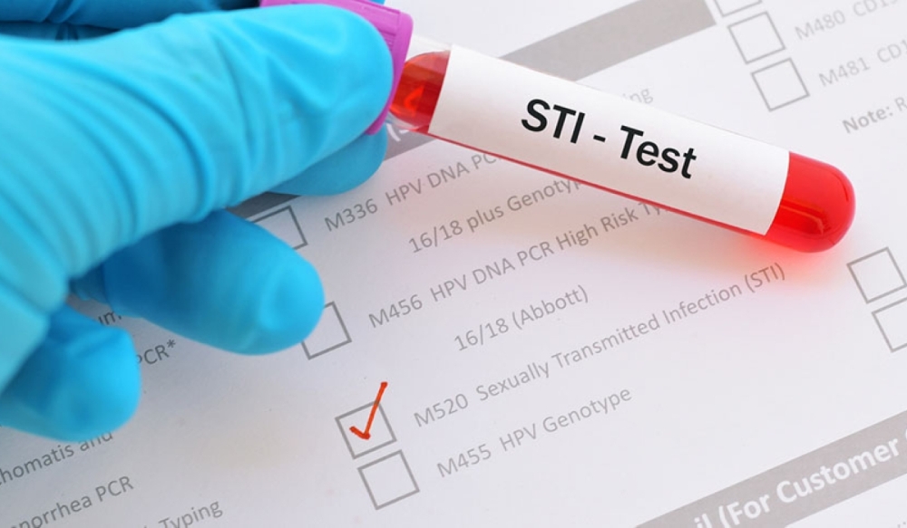 An increased number of Rwandans sought medical attention for sexually transmitted infections (STIs) in 2023. COURTESY