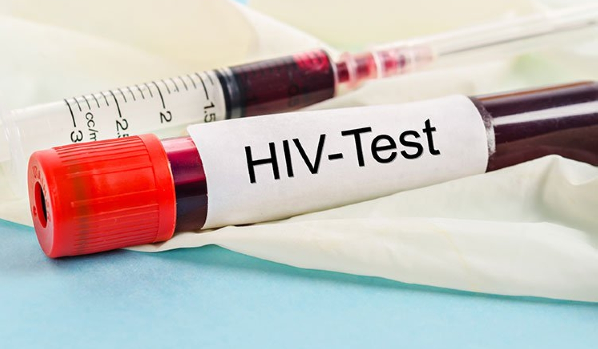 In Rwanda HIV prevention remains the key pillar in the fight against HIV, reducing new HIV infections, and assuring that people living with HIV are diagnosed and initiated on treatment early.