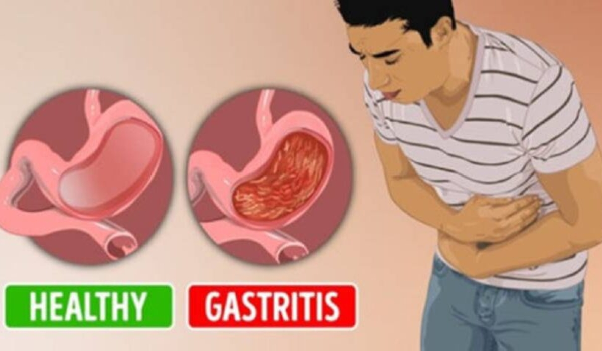 Pain in the stomach, particularly the upper part, is one of the most common problems affecting people.