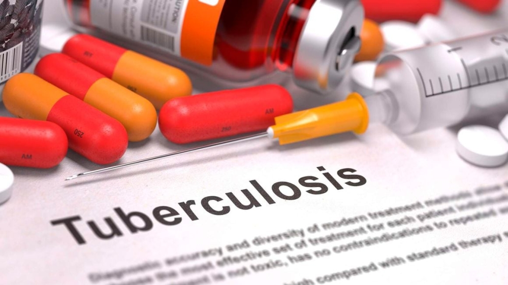 A tuberculosis medical report with composition of medicaments. PHOTO | SHUTTERSTOCK