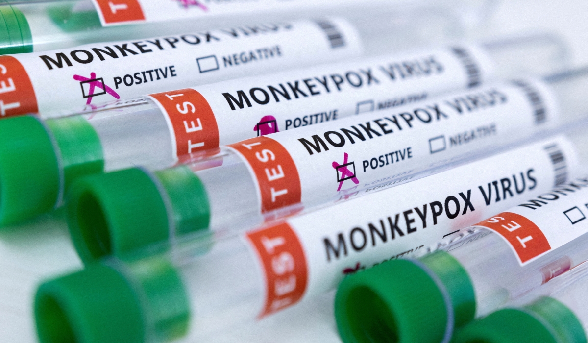 Test tubes labeled "Monkeypox virus positive and negative" are seen in this illustration taken May 23, 2022. REUTERS/Dado Ruvic/Illustration/File Photo