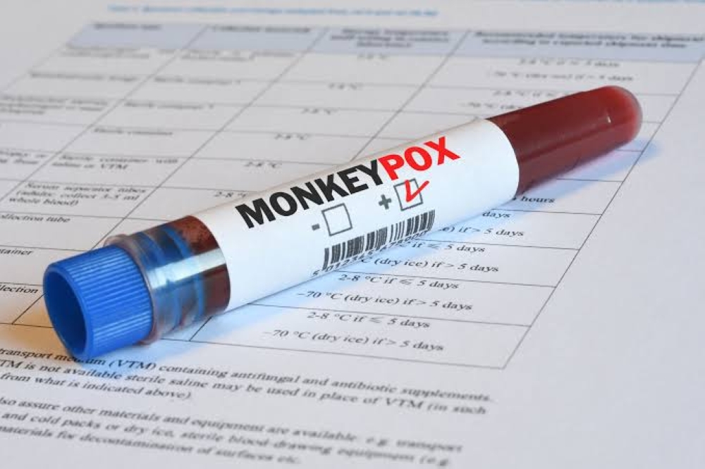 An alarming spread of unvetted information on outbreak of Mpox in Rwanda has highlighted the critical issue of health misinformation on social media.