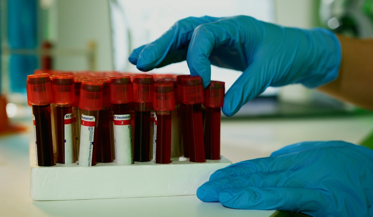 Metabolic dysfunction includes conditions such as being overweight, diabetes, and other metabolic risk factors.