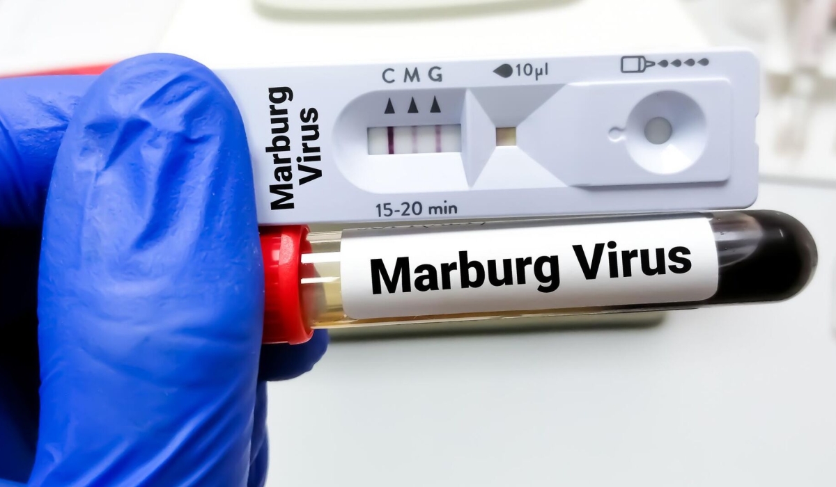 Tanzania has confirmed Marburg virus outbreak