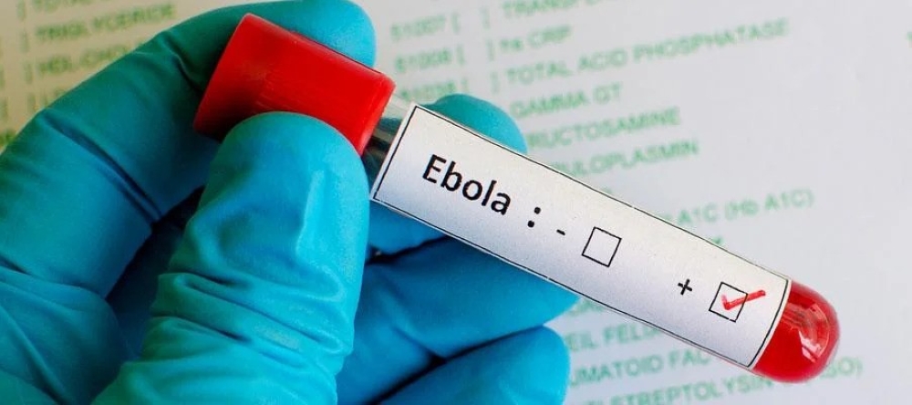 The Ugandan Ministry of Health, on Thursday, January 30, announced that it had confirmed an outbreak of the Ebola Virus Disease in Kampala.