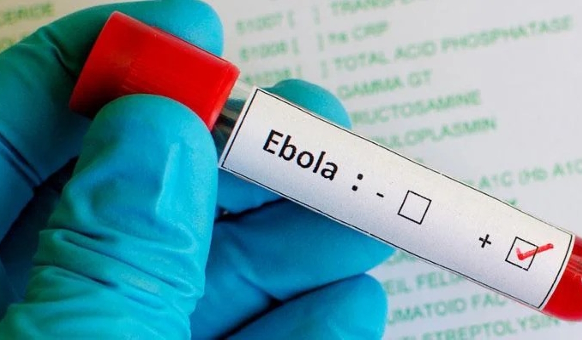 The Ugandan Ministry of Health, on Thursday, January 30, announced that it had confirmed an outbreak of the Ebola Virus Disease in Kampala.