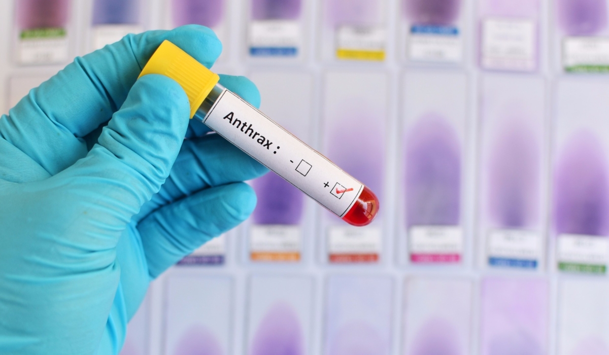 Uganda&#039;s Ministry of Health said Friday that an anthrax outbreak in the northeastern and western regions.