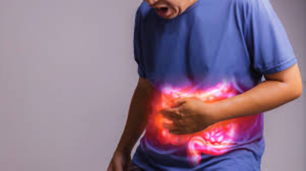 Crohn&#039;s disease is an inflammatory bowel disease that commonly affects the intestines and large intestines.