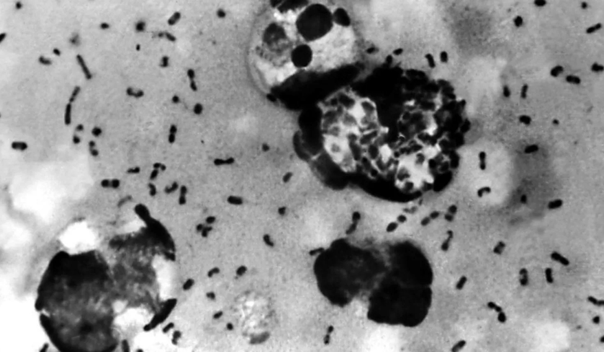 PHOTO CREDIT: CENTERS FOR DISEASE CONTROL AND PREVENTION/GETTY IMAGES