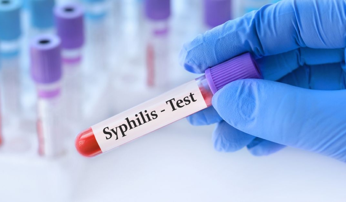 Rwanda is preparing to introduce a new rapid diagnostic test in antenatal clinics across the country as part of efforts to eliminate congenital syphilis by 2030.