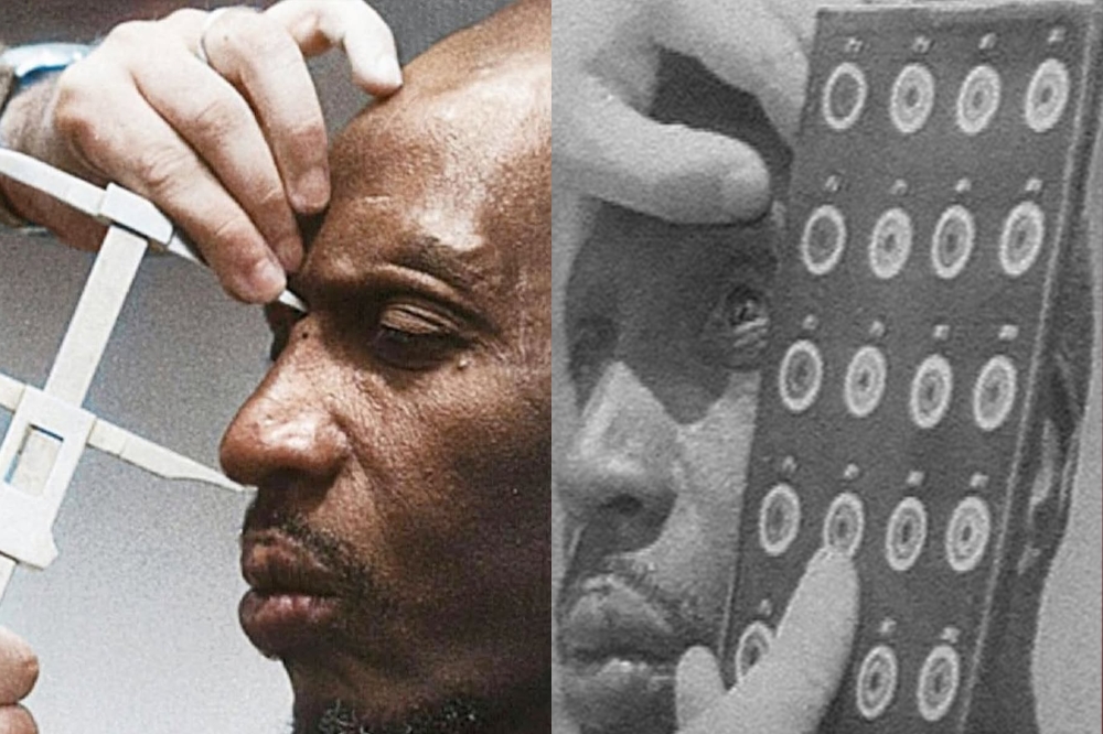 A Belgian doctor measures a man as part of a colonial-era practice used to determine ethnicity. Internet photo