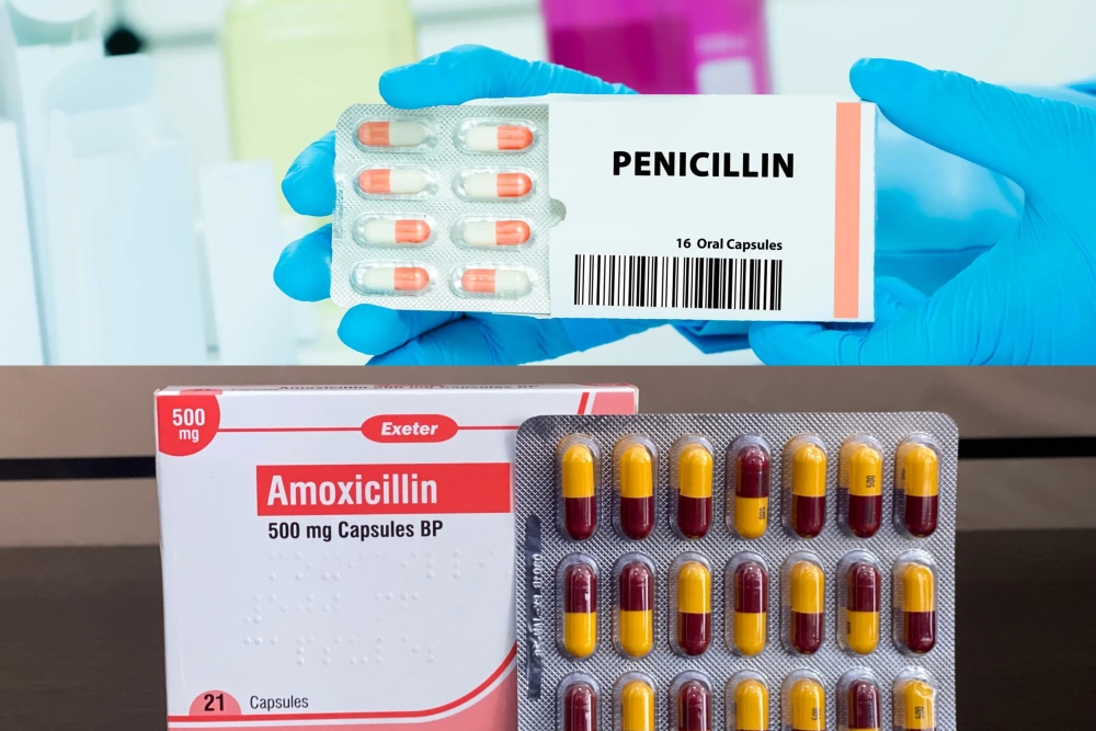 What to know as Penicillin, Amoxicillin lose effectiveness in Rwanda