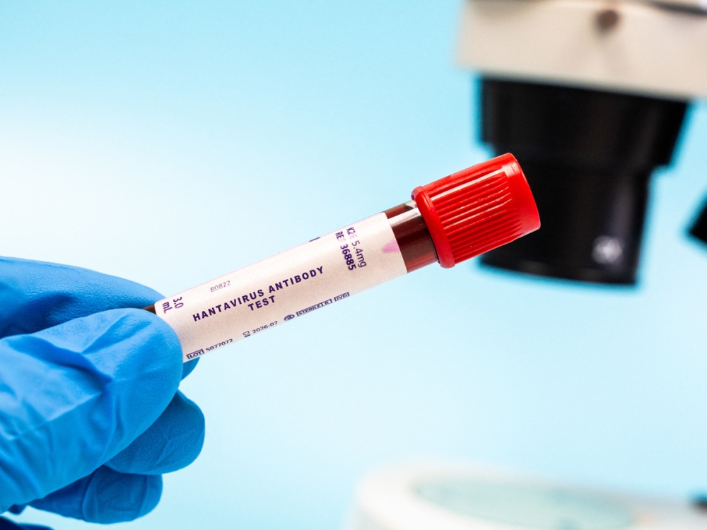 Hantavirus: Rare rodent-borne virus linked to severe disease