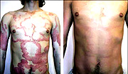 Skin-diseases.
