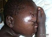 He was assaulted by militia loyal to Robert Mugabe and Zanu PF. His parents were targetted for supporting the opposition party, the MDC. (File photo).