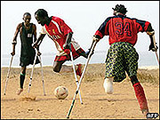 Effects of long time conflict and war still haunt Sierra Leone. (Net photo)