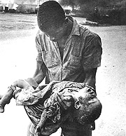A child casualty of the Biafra War Nigeria.