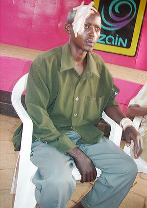 George Nsengiyunva one of the victims of the on-going attacks on Banyarwanda in Uganda's Masaka district.