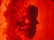 The debate on the right to life of the foetus in the womb has begun in Rwanda