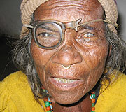 Notice her broken glasses and mature cataract.