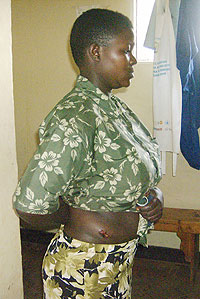 Injured Adeline Uwimana receiving first aid at Ndego health centre. (Photo: S. Rwembeho)