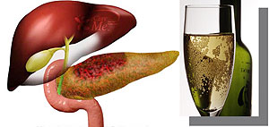 L-R : Acute Pancreatitis ; Alcohol abuse can lead to acute pancreatitis.