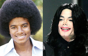 Some surgeries can turn out awful as seen in these before and after shots of late King of Pop Michael Jackson