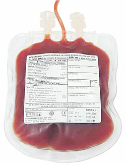 Blood for transfusion needs to be tested for the hepatitis B virus (Internet Photo)