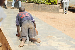 A polio victim in Kigali. Commonwealth leaders have renewed commitment to eliminate polio. The New Times / File photo