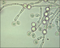 Candida Albicans is a widespread organism that normally lives in healthy balance in the body, found in the vagina, mouth, digestive tract and on the skin without causing disease or symptoms. Net photo.