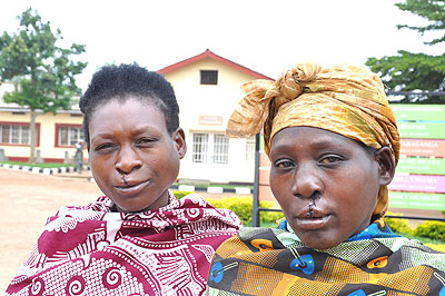 Some of the beneficiaries of the free cleft lip surgery in Rwamagana.  The New Times/ Stephen Rwembeho.
