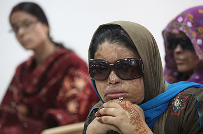 An acid called u201cTezaabu201d, which is designed to clean rusted tools, is often used in the attacks. Net photo.