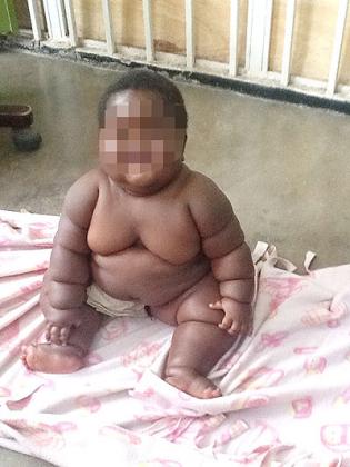 Baby Aline smiles last week. She needs more intervention to be able to smile without arousing pity.   The New Times/ Seraphine Habimana.