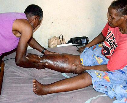 Mujawimana being nursed by her husband. The New Times/Joseph Oindo