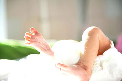 One in 10 babies (15 million worldwide) are born premature One million of these babies die soon after birth. Net photo.