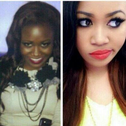 Before and After: Kenyan socialite Vera Sidika admitted to a skin lightening procedure and getting breast implants. (Internet photo)