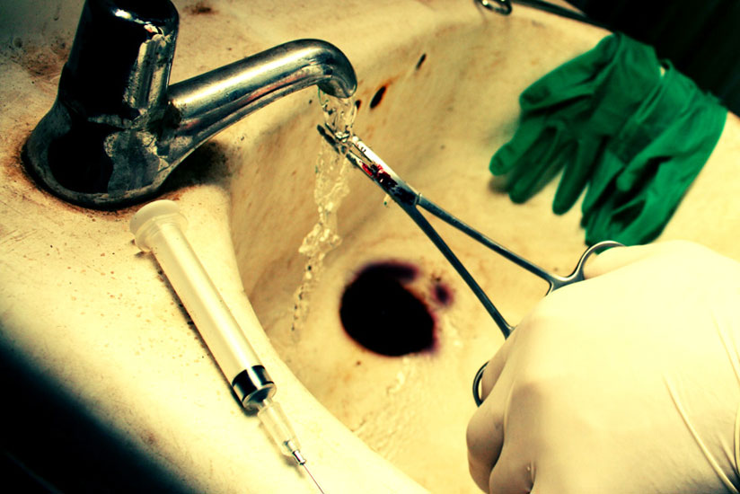 A doctor cleans medical instruments after performing an abortion. (Net)