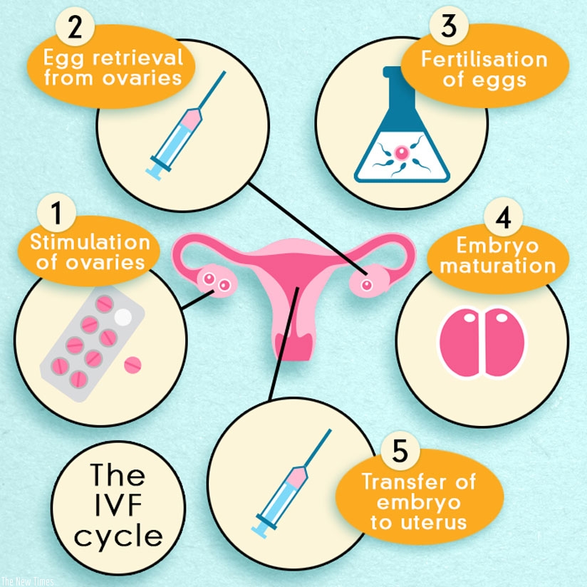 A graphic illustration of how the IVF procedure is done. (Net photo)
