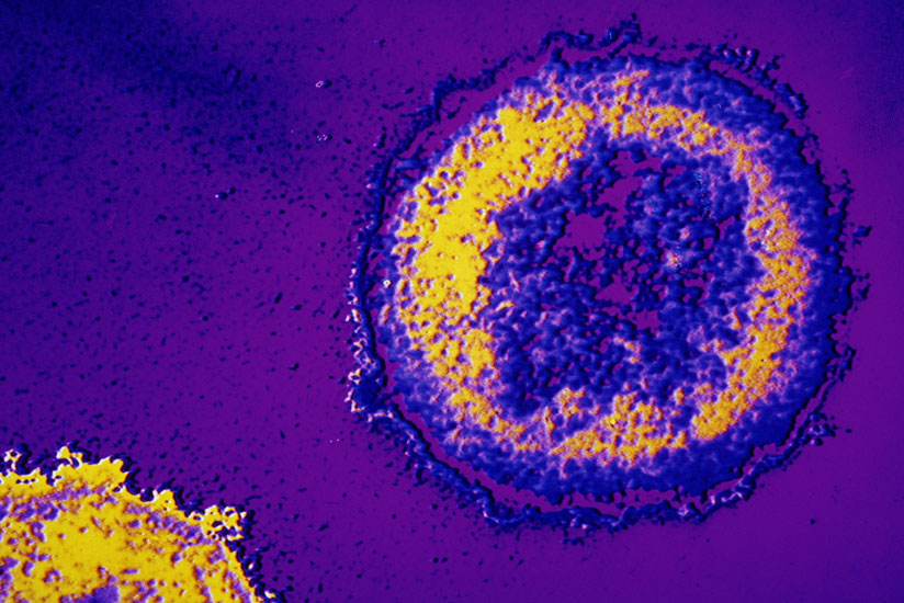 Microscopic HIV virus. Early tests on the first person to complete the treatment show no signs of the virus in his blood. / Photograph: GeoStock/Getty Images
