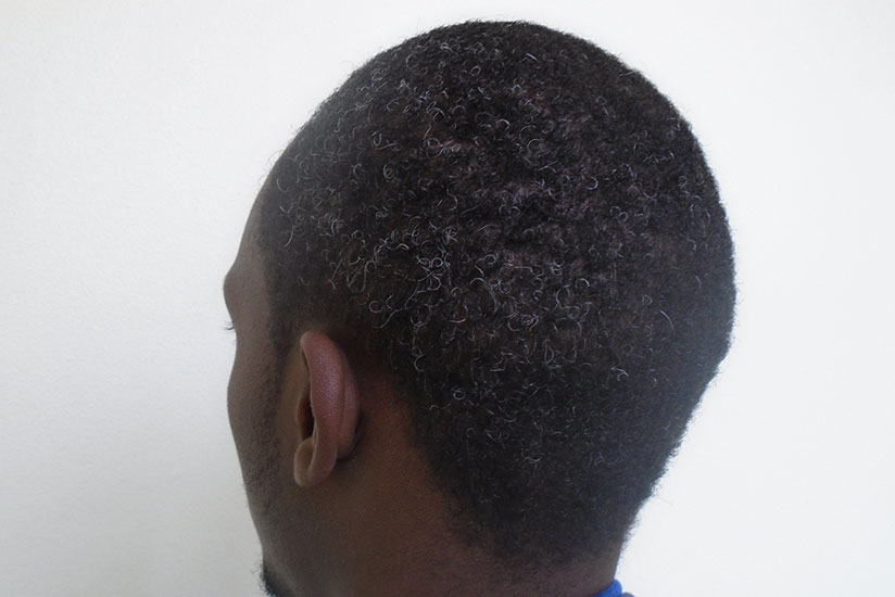 A young man with gray hair. Early graying is linked to genetic factors. / Lydia Atieno