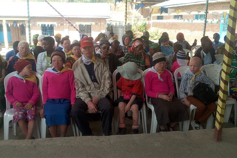 People with albinism in Musanze District gathering in a meeting. / Remy Niyingize