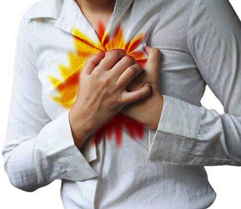 The commonest symptom of acid reflux disease (GERD) is a heart burn. / Net photo. 