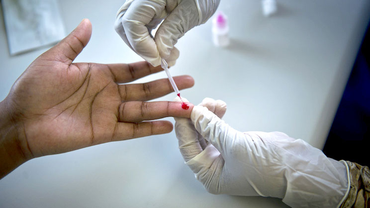 A person being tested for HIV/AIDS.