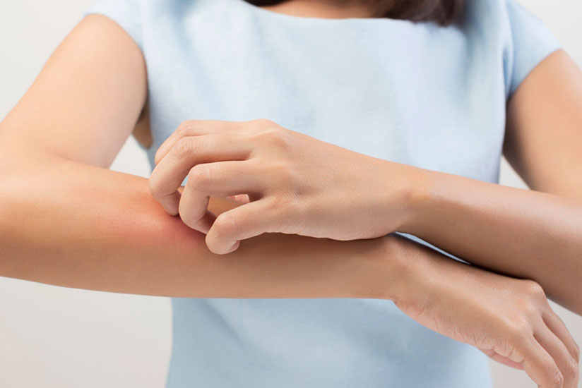 An itchy skin is a common symptom of an allergic reaction. / Net photo.