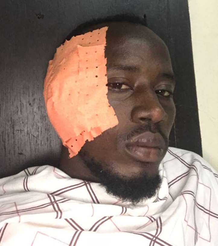 Nsabimana after undergoing surgery. Net photo.