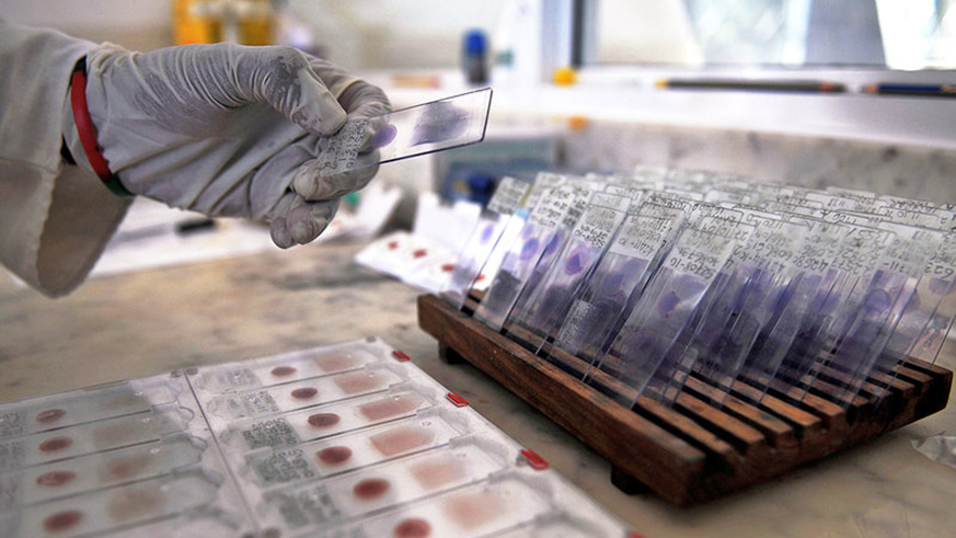 A laboratory technician prepares blood samples from volunteers for viral-genotyping at the government-run Ifakara Health Institute in Bagamoyo, 70 kms north of Dar es Salaam. / Courtesy