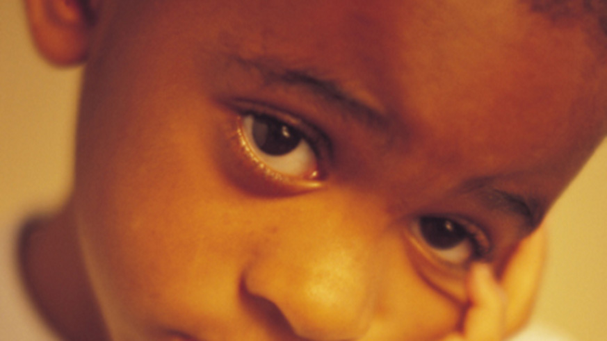 Autism is diagnosed by clinical features, excluding other genetic and chromosomal abnormalities.  